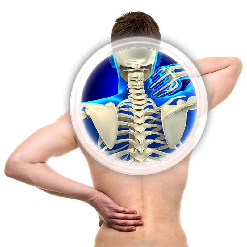 Artrodese cervical